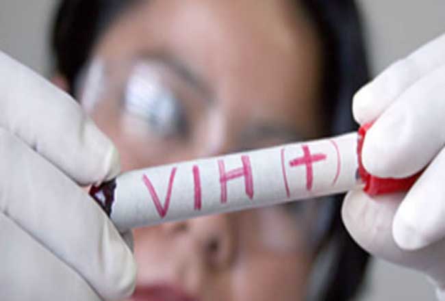 Semana Europeia da Primavera do Teste do VIH-Hepatites em país