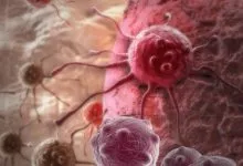 Cancro do Pâncreas: Uma Batalha Contra o Silêncio – Por Alexandra Fernandes