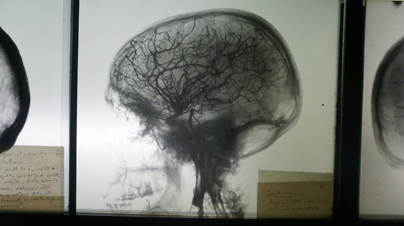 Congresso da Sociedade Europeia de Neurorradiologia honra Egas Moniz