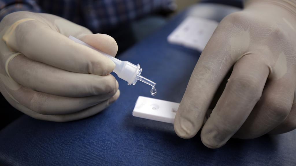 Testes rápidos voltam a ser gratuitos nas farmácias já esta terça-feira