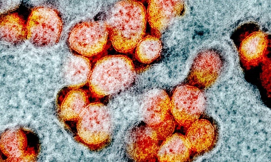 Covid-19. Infeções estão a subir nos mais jovens